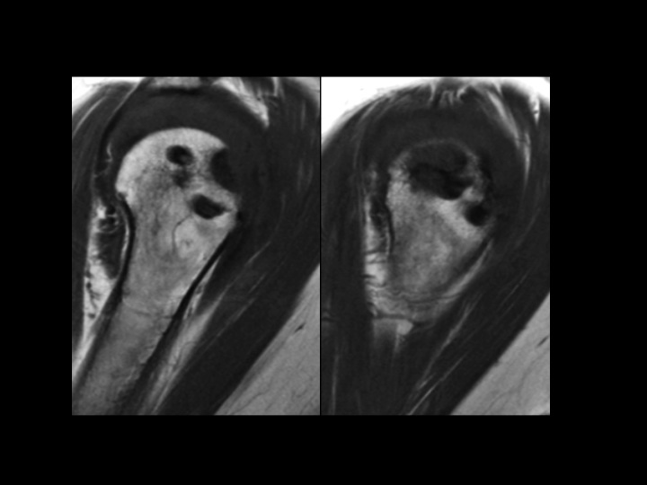 Figure 2 for case fixation device ( RID5471 )